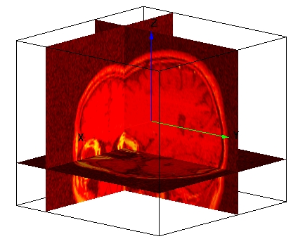Gizmo slices through MRI data