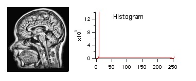 adaptive histogram equalization