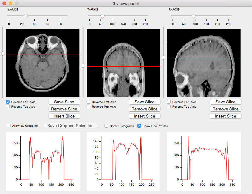 mri views