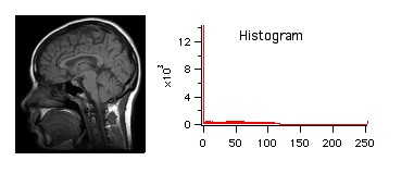 std. MRI image